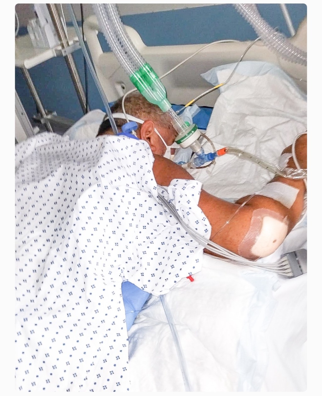 Azerbaijani swearing blackmailer who considered himself a criminal authority Vidadi İsgandarli  dies after attack in&nbsp;France?